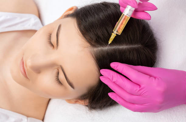 PRP Hair Treatment in Riyadh